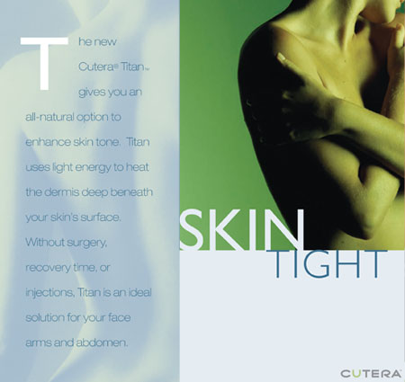 SkinTight Miami Beach, Skin Tight Cutera® Titan Skin Enhancer South Beach